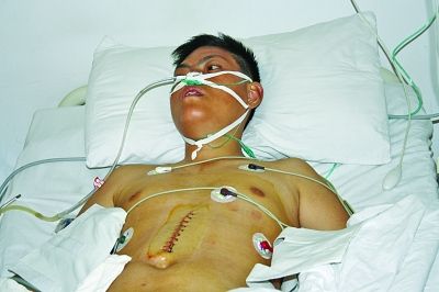 男子自稱被父母逼其吞下22顆鐵釘 遭遇駭人