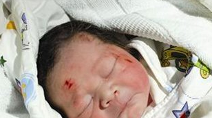 男嬰車禍中誕生