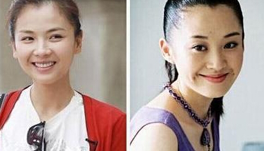 許晴拉黑鄭佩佩
