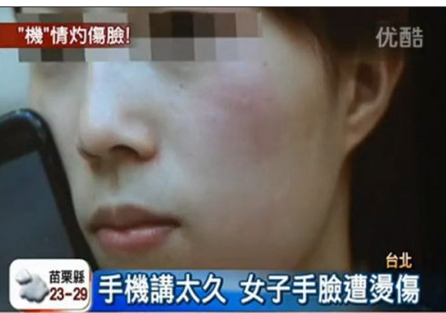 手機發熱被燙傷