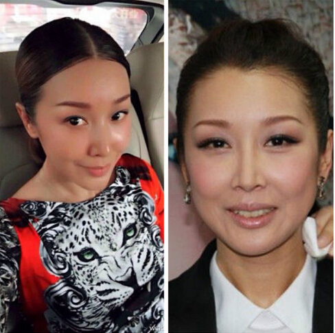 歌手孫悅整容