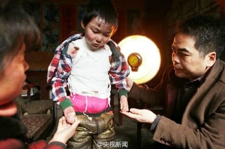 “活在衛(wèi)生紙里”的男孩 